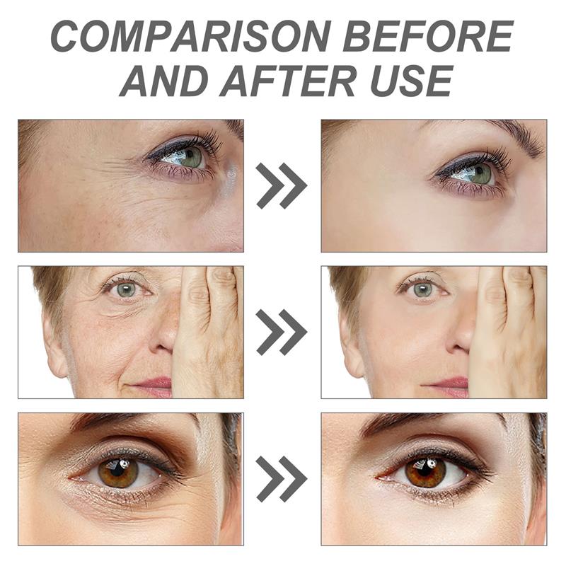 سيروم الريتينول لإزالة التجاعي - مراجعة The Ordinary Serum Hyaluronic Acid وسعره