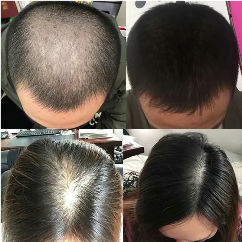 سائل نمو الشعر من أوفرلورد يمن - مراجعة Hair Care Or Haircare وسعره