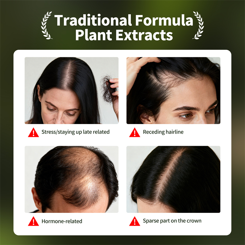 مجموعة نمو الشعر الطبيعي صابون - مراجعة Hair Care Herbal وسعره