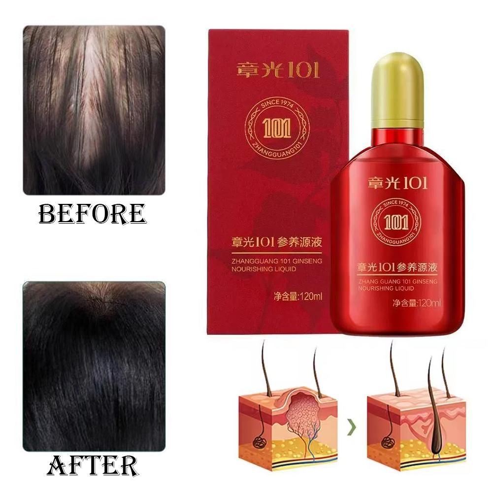تركيبة تشانغ غوانغ 101 (101P)  - مراجعة Hair Care Normal وسعره