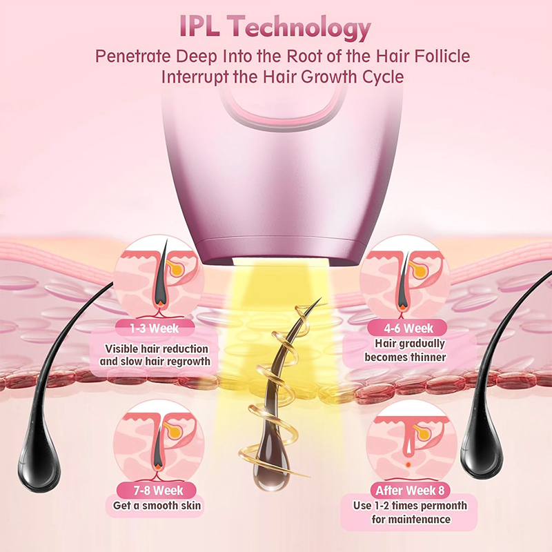 آلة إزالة الشعر بالليزر IPL، أ - مراجعة Hair Care Or Haircare وسعره