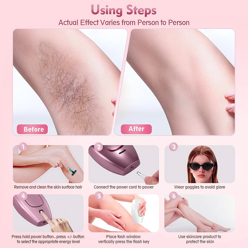آلة إزالة الشعر بالليزر IPL، أ - مراجعة Hair Care Or Haircare وسعره