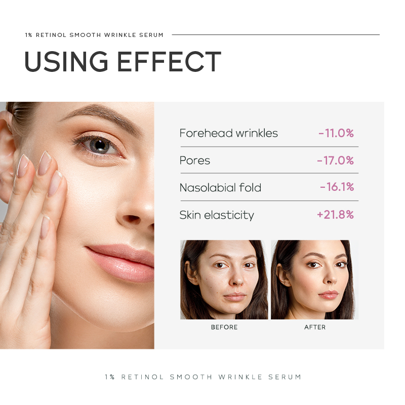 سيروم كويوم 1% ريتينول لتنعيم  - مراجعة The Ordinary Serum Hyaluronic Acid وسعره