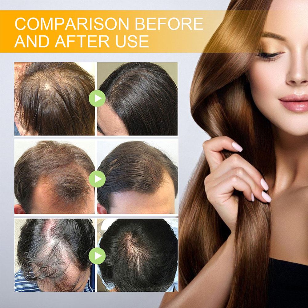 5/3/1 قطعة البيوتين منتجات نمو - مراجعة Hair Care Herbal وسعره